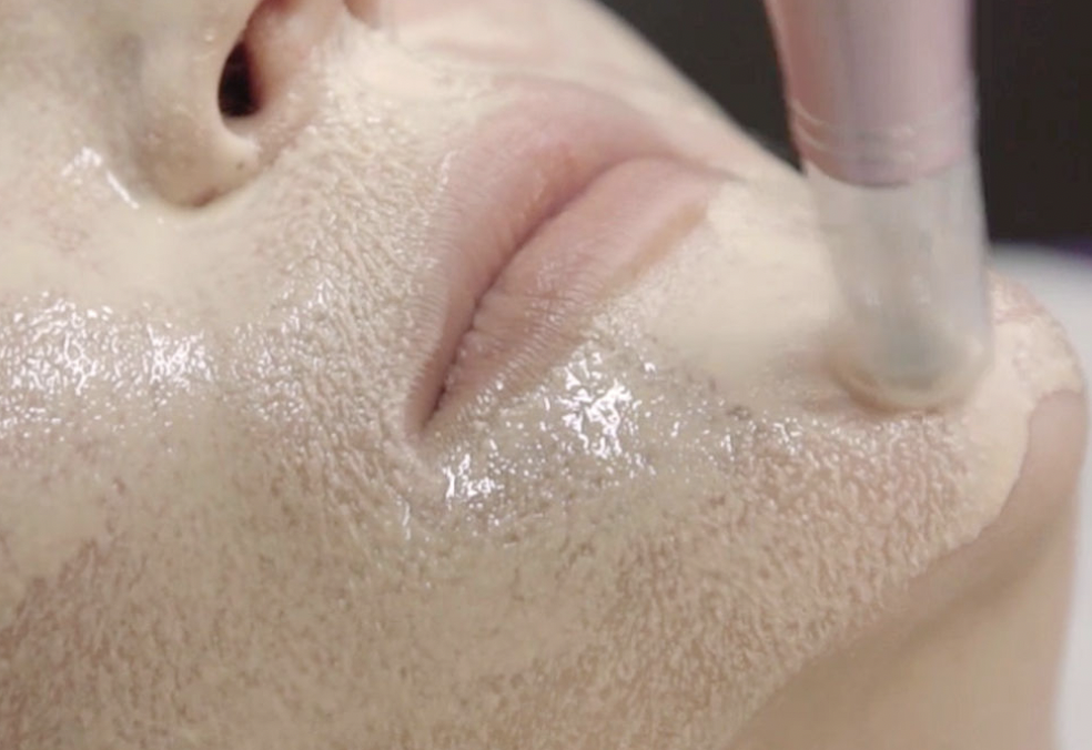 Facial, échographie, pelage, dermapen, collagène et photothérapie